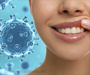 薄而软牙龈:口腔健康这是什么意思?