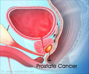 多种细胞类型与前列腺癌的治疗耐药性有关