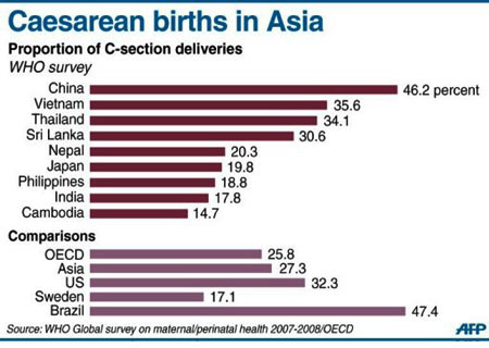 剖腹产出生在亚洲