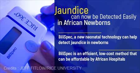 在非洲新生儿中检测黄疸的低成本方法
