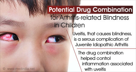 治疗儿童关节炎相关性失明的新药物