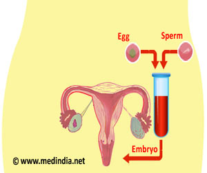 体外受精(IVF)
